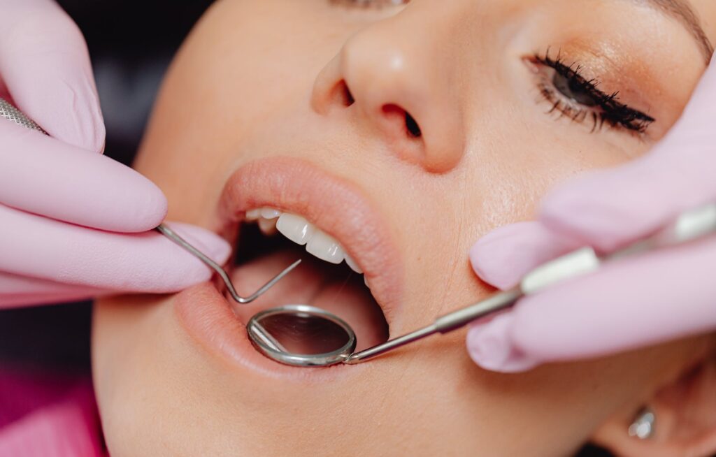 close up photo of a woman getting a dental check up