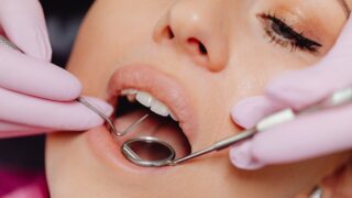 close up photo of a woman getting a dental check up